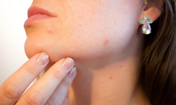 Jakie są choroby dermatologiczne i sposoby ich leczenia?
